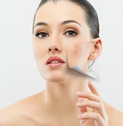 E' peggio cercare di nascondere l'acne giovanile? - Articoli & News - Farmabeauty